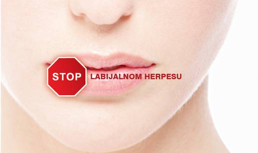 Nova generacija lijekova za herpes