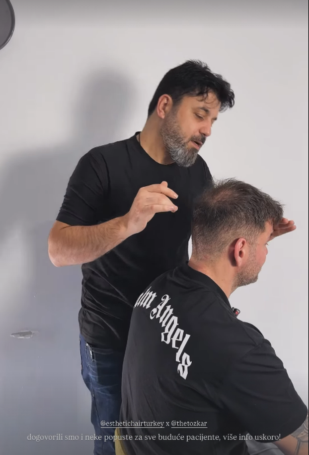 Zanima vas kako izgleda transplantacija kose? Sandi Pego otkrio detalje operacije