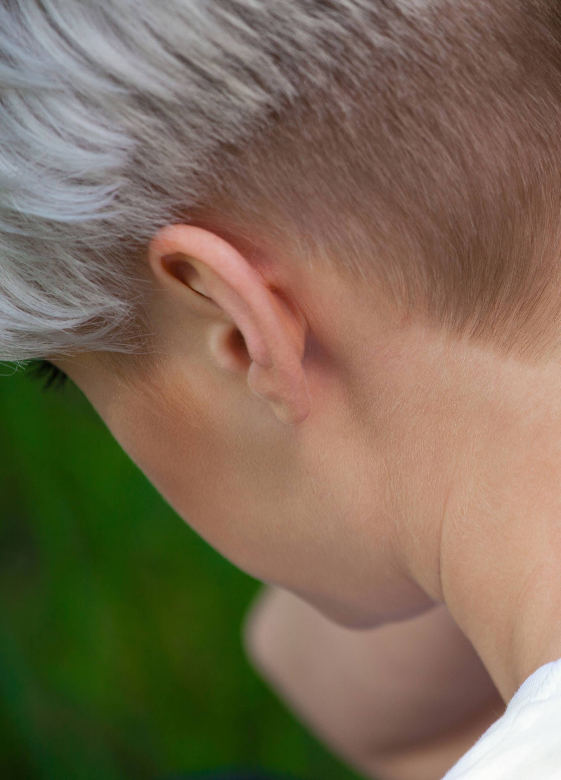 Mosquito bite to the neck .