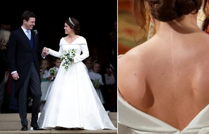 Princeza je ponosna na ožiljak: Odjenula haljinu otvorenih leđa