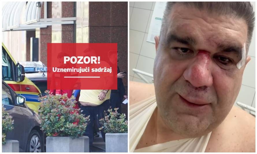 Oglasili se srpski menadžeri koji su se tukli u Zagrebu. Mirković: Ruka je slomljena na tri mjesta!