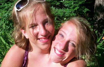 Sijamske blizanke Abigail i Brittany (22) zvijezde realityja 