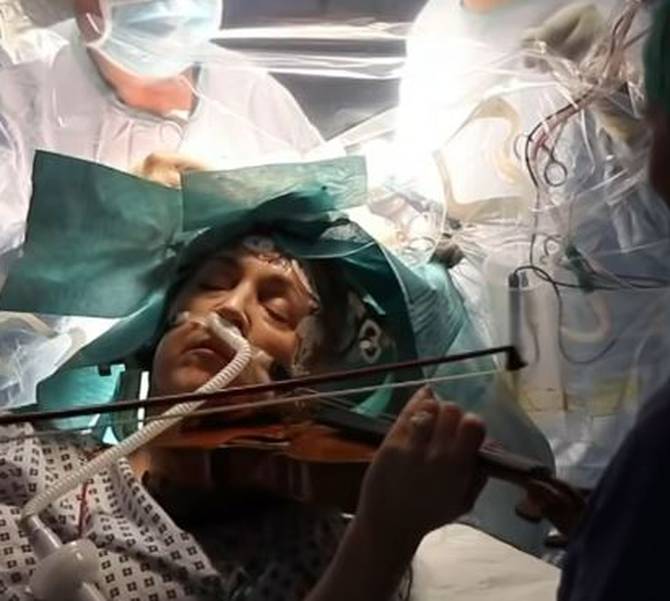 Usred operacije tumora mozga pacijentica je zasvirala violinu