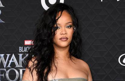 Rihanna otkrila zašto je izgubila kosu: Nisam to tako očekivala
