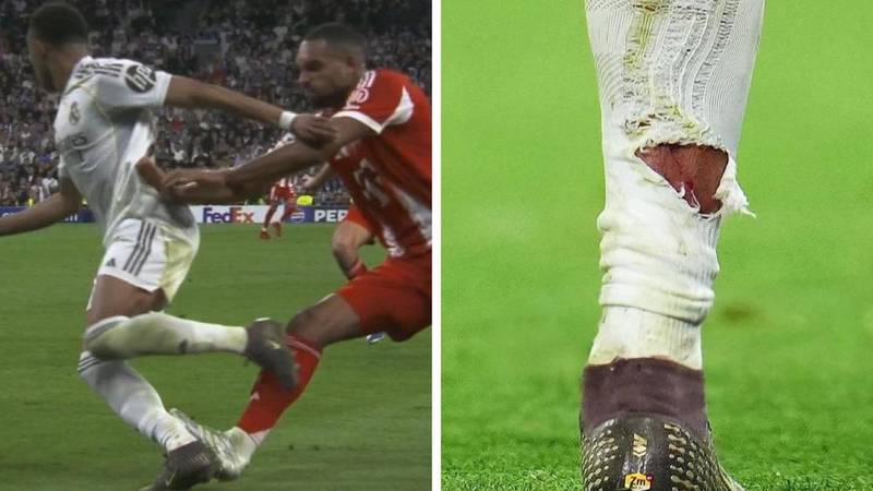 Alvaro Arbeloa se požalio: Ne razumijem kako Tah nije dobio crveni karton za ovaj prekršaj