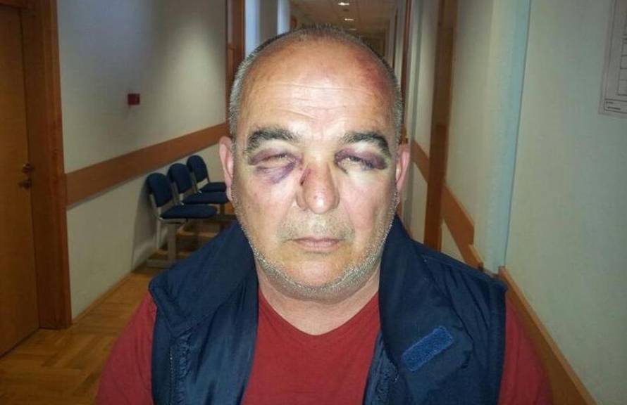 Robinja iz Poreča: Tukli su me, polijevali solnom kiselinom...