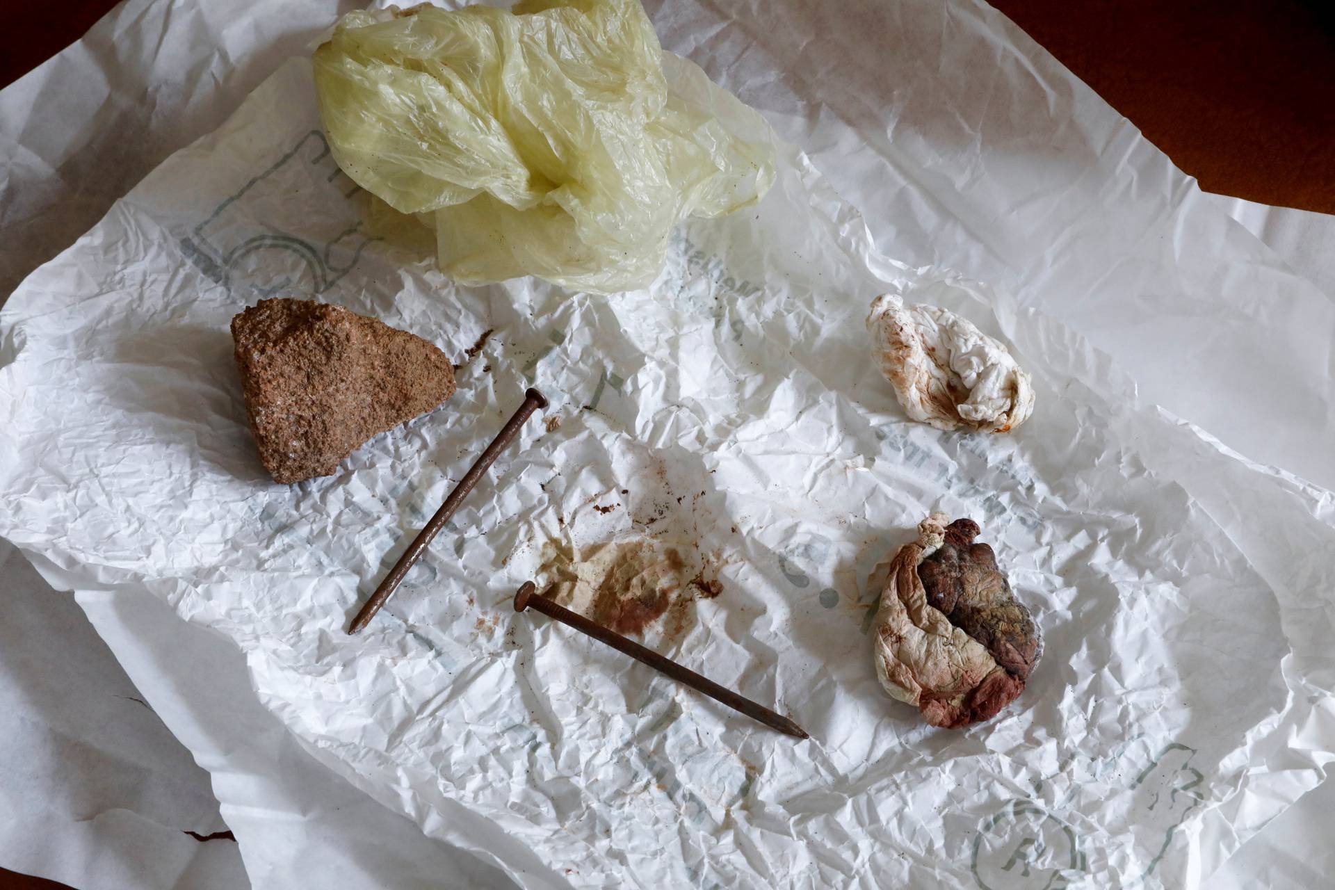 Items that doctors said they retrieved from the vagina of a rape survivor are seen at a hospital in the town of Adigrat, Tigray region