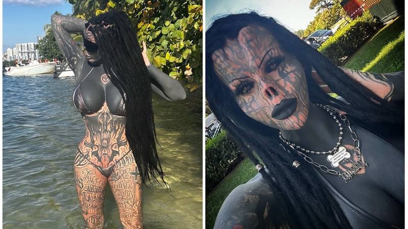 FOTO Uznemirujuće! Uklonila je čak i vrh nosa, a evo kako je izgledala: Šteta, ljepotica si bila