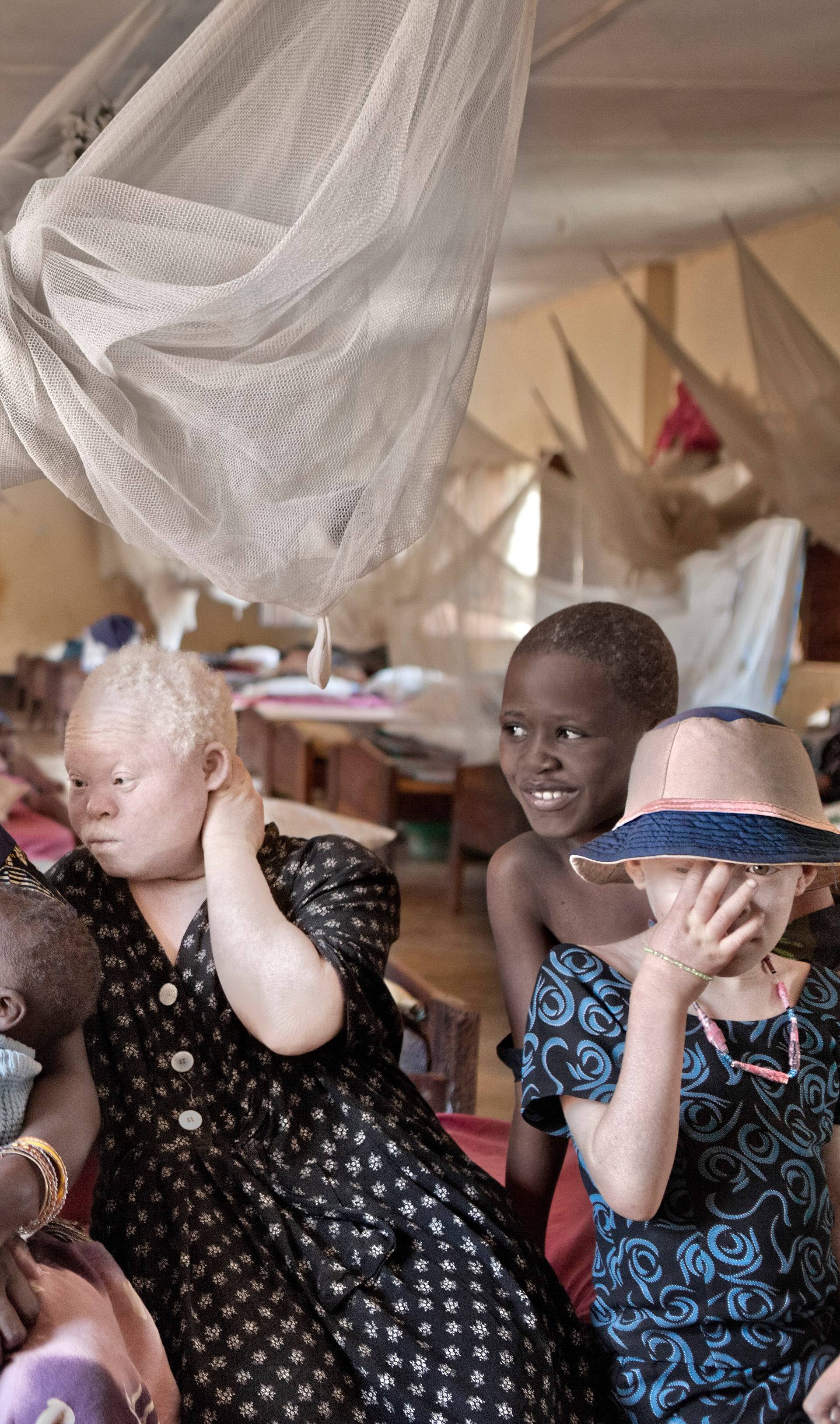 Persecuted: Albino People Seek Refuge From Vicious Body Part Traffickers