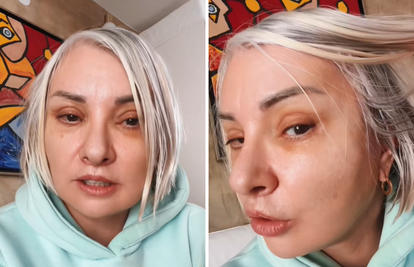 Danijela Dvornik pokazala kako izgleda 16 dana nakon operacije lica: 'Oči su još uvijek natečene'