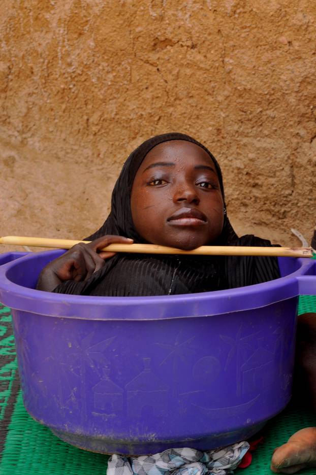 The Girl Who Lives In A Bowl: BORN DIFFERENT