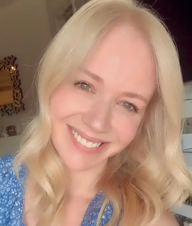 FOTO Evo kako izgledaju naši slavni bez photoshopa i filtera