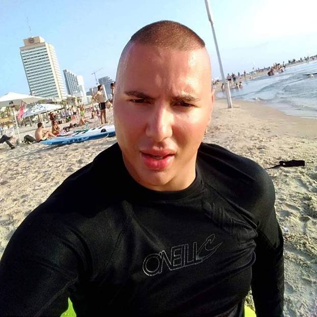 FOTO Sjećate li se Brendona iz BB-a? 'Estetske operacije su mi totalno upropastile lice...'