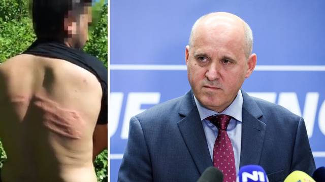HDZ-ovac Branko Bačić o snimci na kojoj mlate migrante: 'Treba vidjeti jesu li pružali otpor'