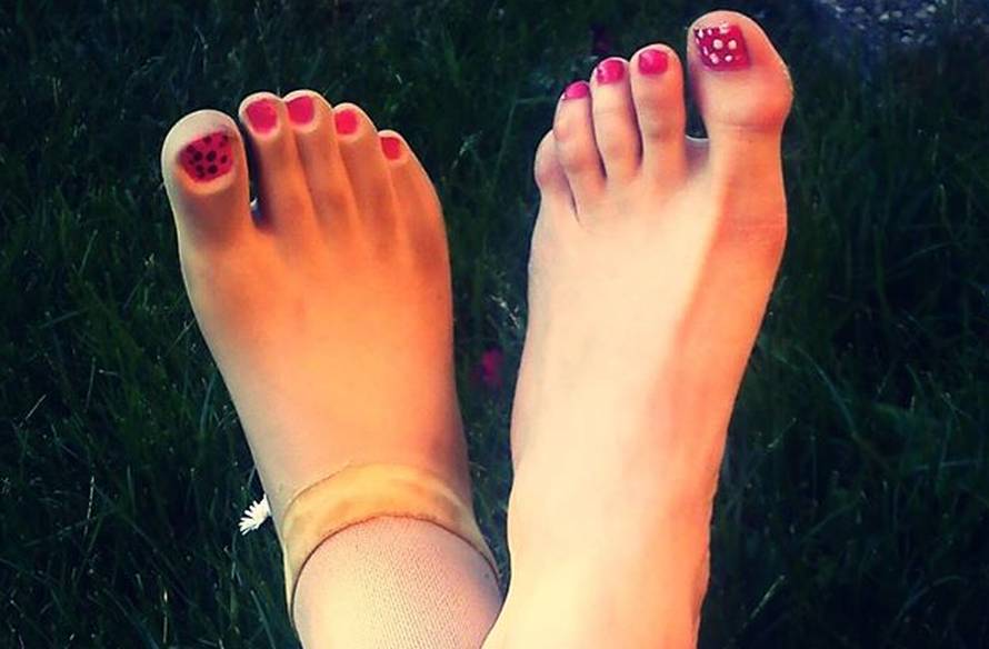 U Lanu zure zbog kraće noge i proteze, no ona se ne obazire