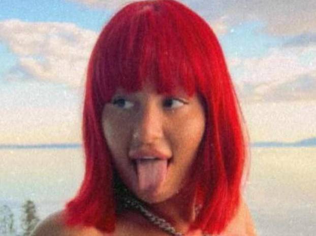 Na istog se estetskog kirurga žalila i Kristina Mandarina. Pogledajte kako je izgledala