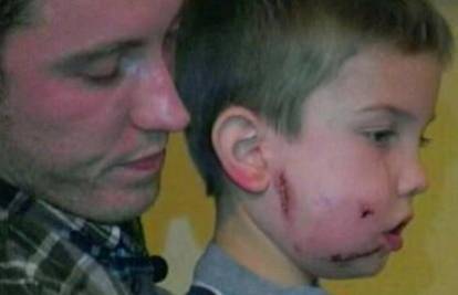 Puma napala dječaka i izgrizla ga po licu, otac je ubo nožem