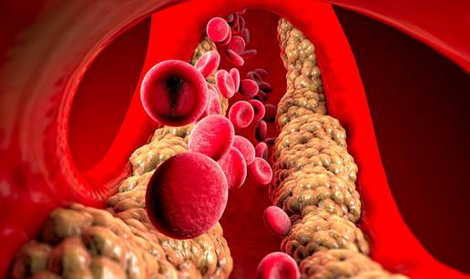 Studija otkriva: Jedna promjena u prehrani sni&zcaron;ava kolesterol