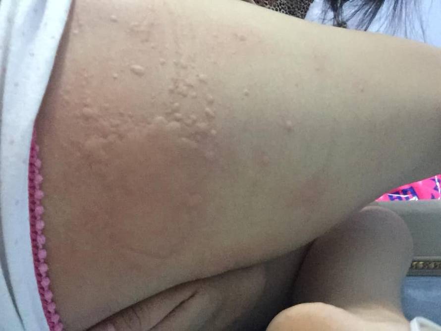 'Stanje je nepodnošljivo, zbog smoga svi krvarimo i kašljemo'