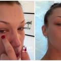 VIDEO Bella Hadid o izazovima nakon infekcije čeljusti: 'Molim vas, poslušajte svoje tijelo...'