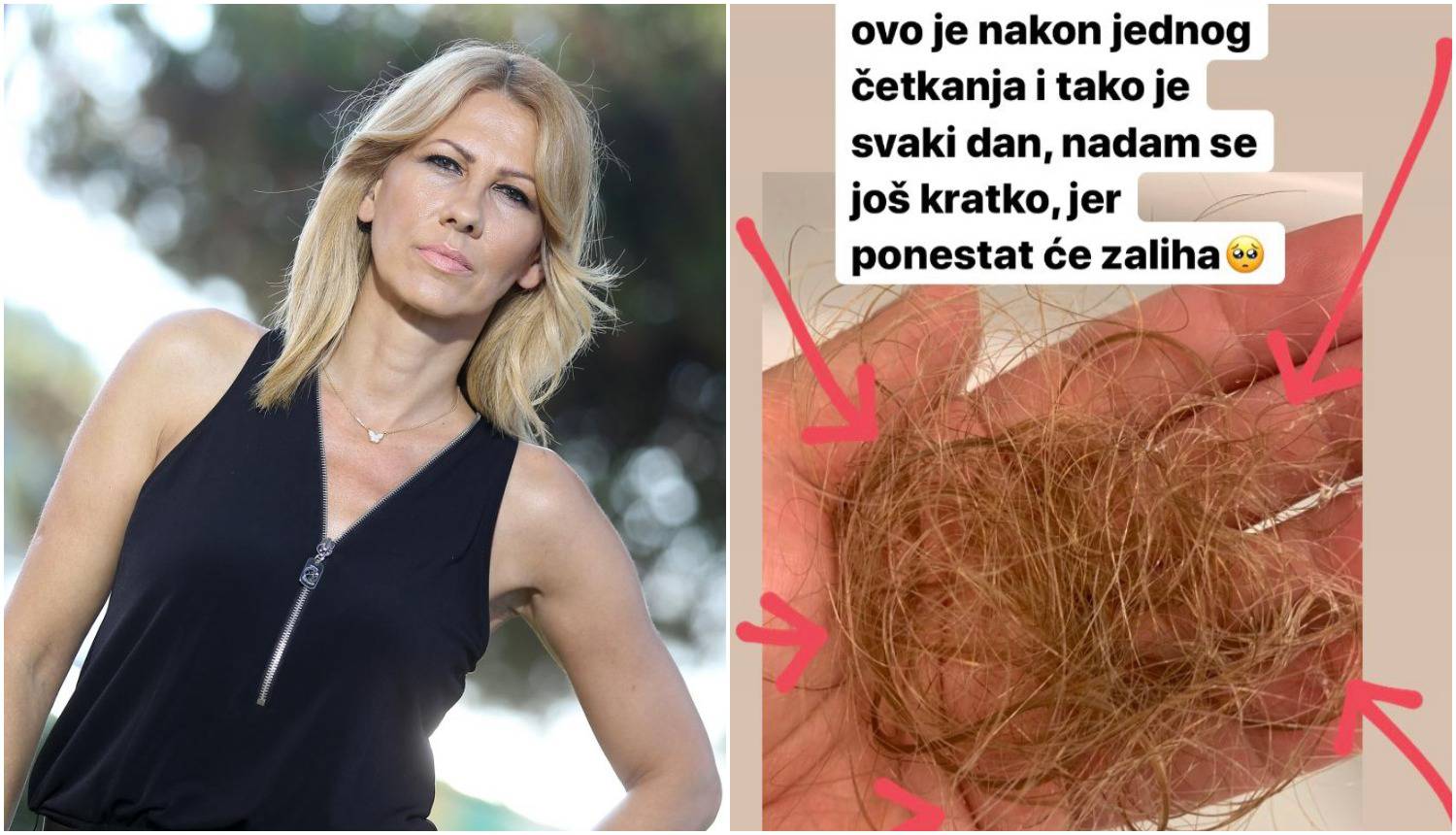 Mirna Zidarić uplašila fotkom: Zbog korone joj ispada kosa...