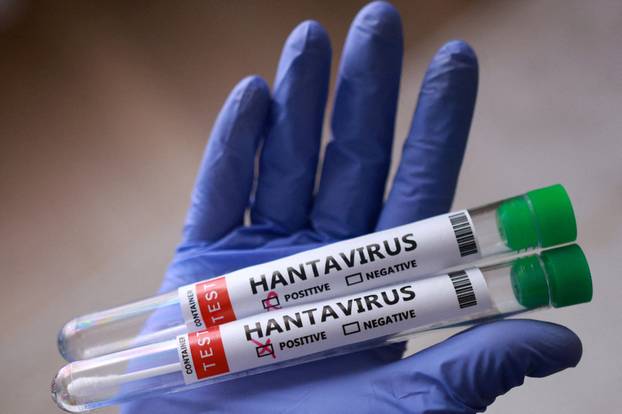FILE PHOTO: Illustration shows test tubes with "Hantavirus positive" label
