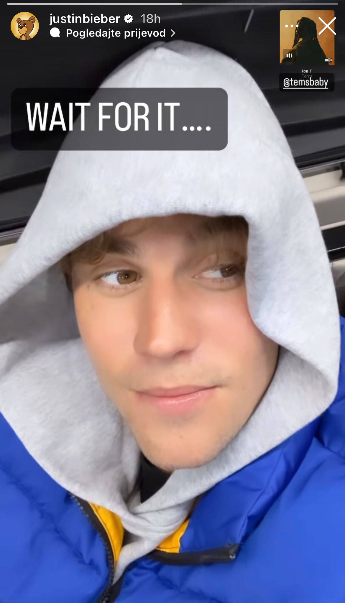 Justin Bieber snimio video kako pomiče lice zbog teške borbe sa sindromom: 'Ide mu sve bolje...'