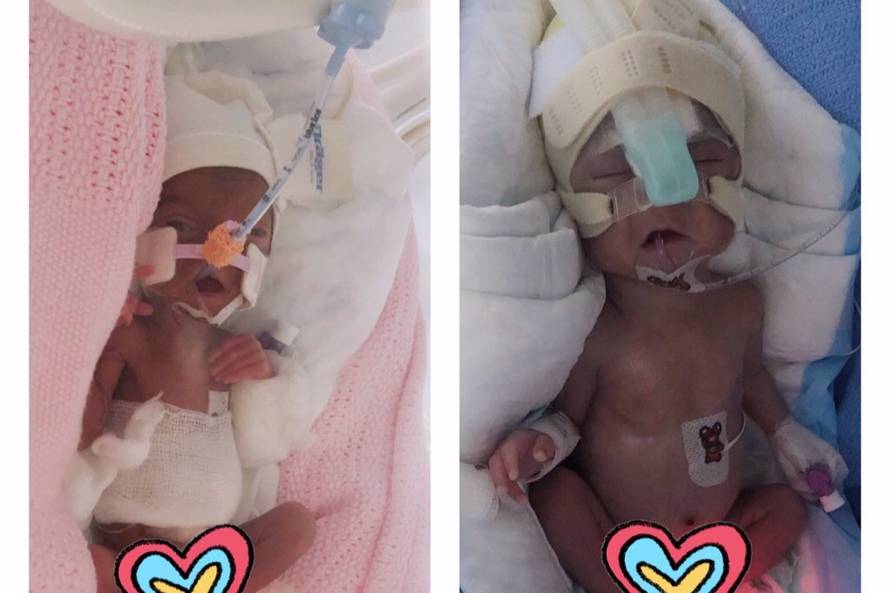 Ne daju im bebu iz bolnice dok ne plate račun od 836.000 kn!