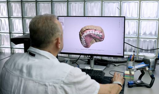 Kako suvremena implantologija rje&scaron;ava bezubost uz manji stres