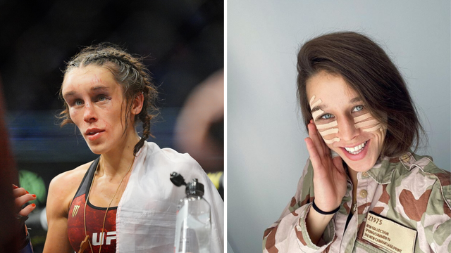 Skoro kao nova: UFC borkinja oporavila se od deformacije lica