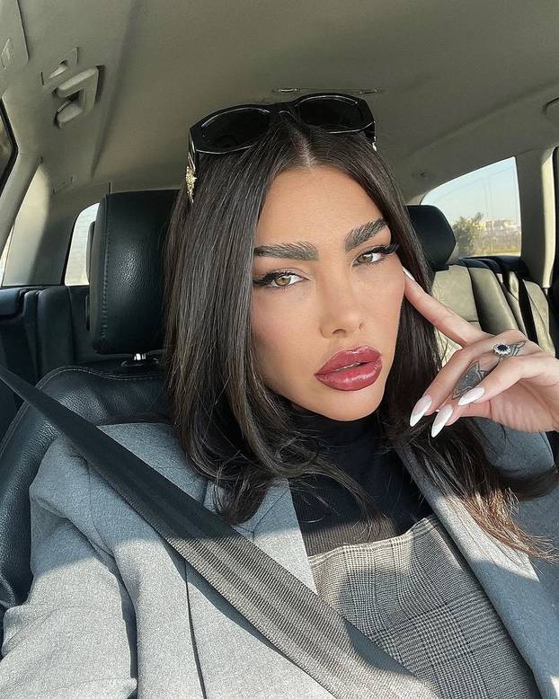 FOTO I misica Annie Šukunda tvrdi da je žrtva zagrebačkog kirurga: 'Radi na živo! Horor...'