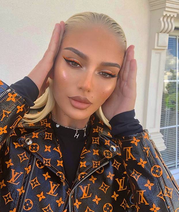 Niko Kovač gubi živce i zvijezdu zbog zahtjeva fatalne Albanke?