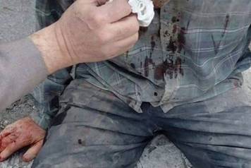 Civilians Injured and Vehicles Ablaze as US and Israel Launch Strikes on Iran - 28 Feb 2026