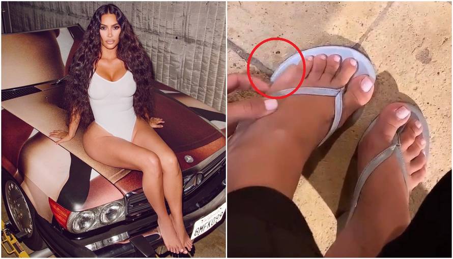 Kim pokazala šesti 'prst' na nozi o kojem se priča: 'Zbunjujuće je'