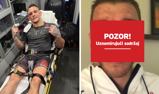 UFC masakr: Poirier je Hookera čak 131 put pogodio u glavu, a obojica su završila u bolnici...