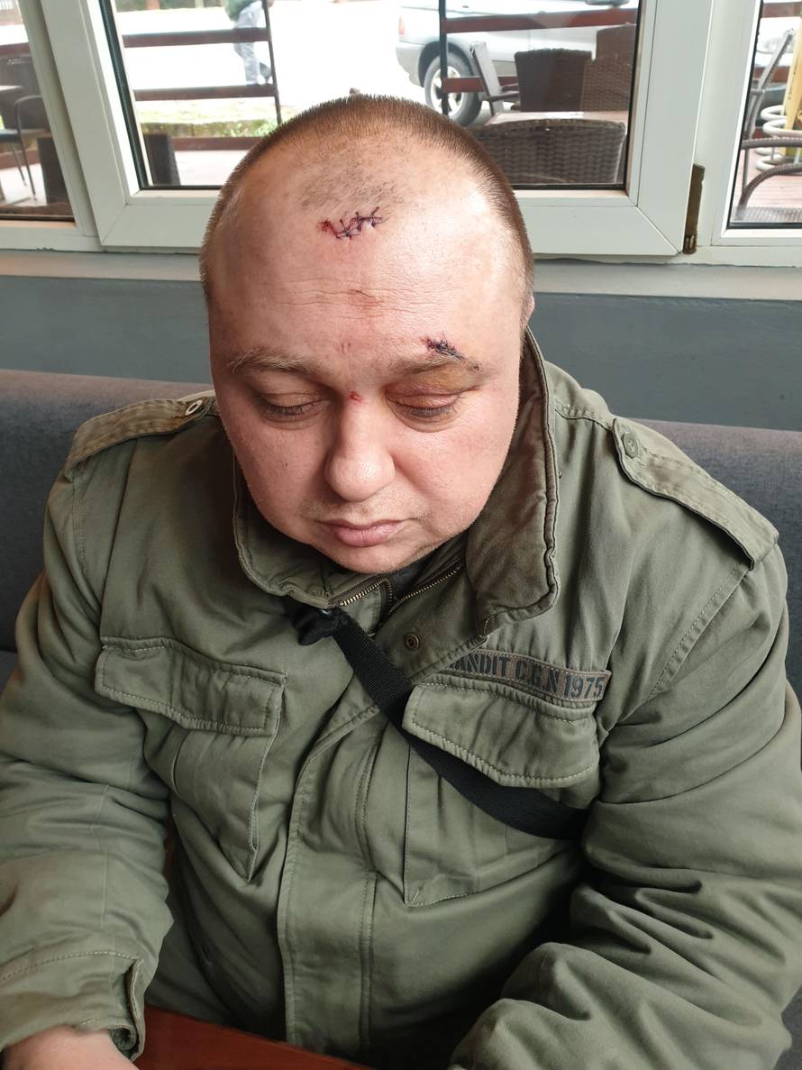 'Prvi me tukao šakama, a drugi me pepeljarom udarao po glavi'