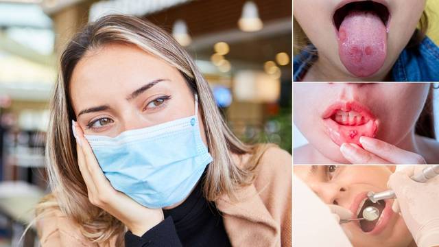 Nošenje maske može biti uzrok ozbiljnih posljedica na ustima i zubima - evo kako se zaštititi