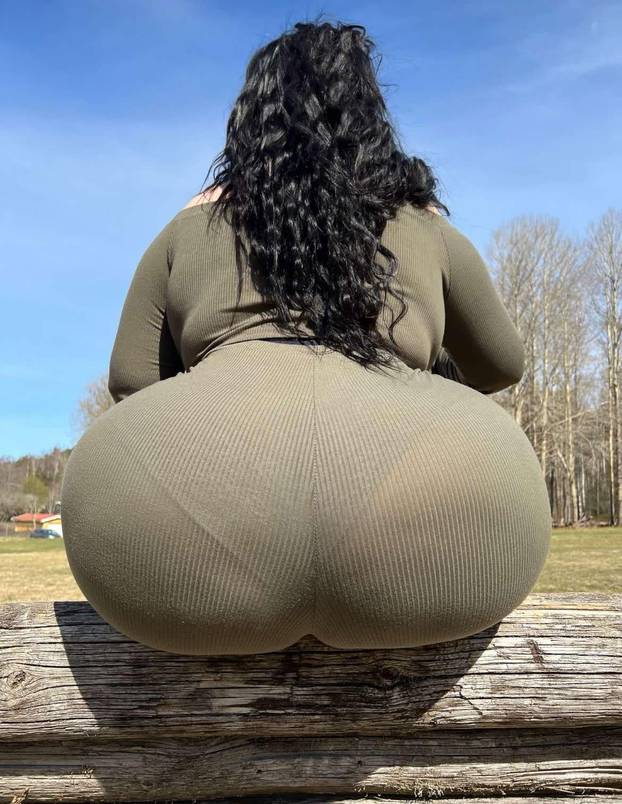 FOTO Stražnjica mi teži 45 kila, no već imam u planu sljedeću operaciju, želim imati najveću!