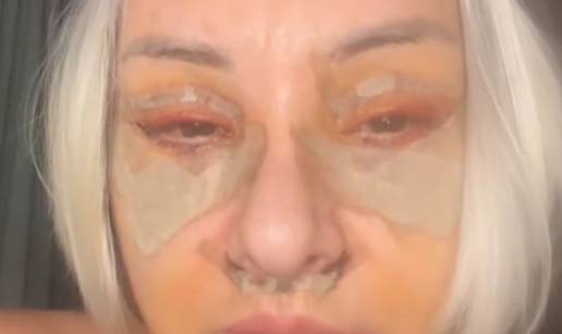 Danijela Dvornik otišla na 'face lift': Evo koliko taj zahvat košta